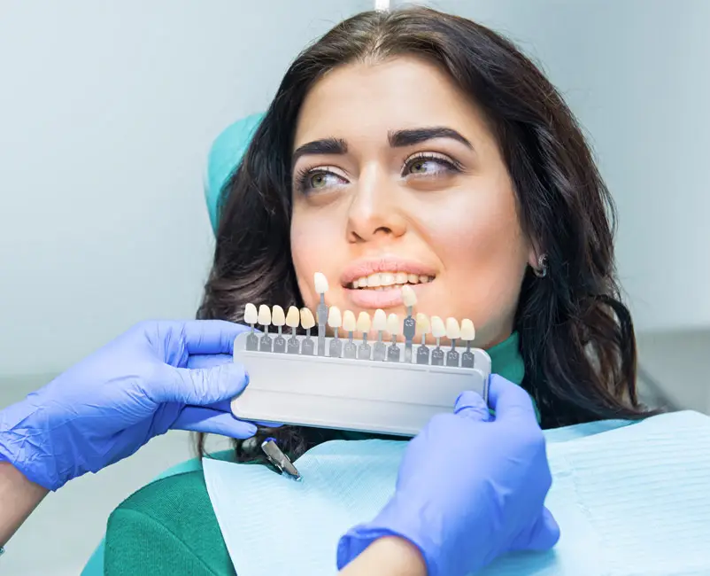 Veneers